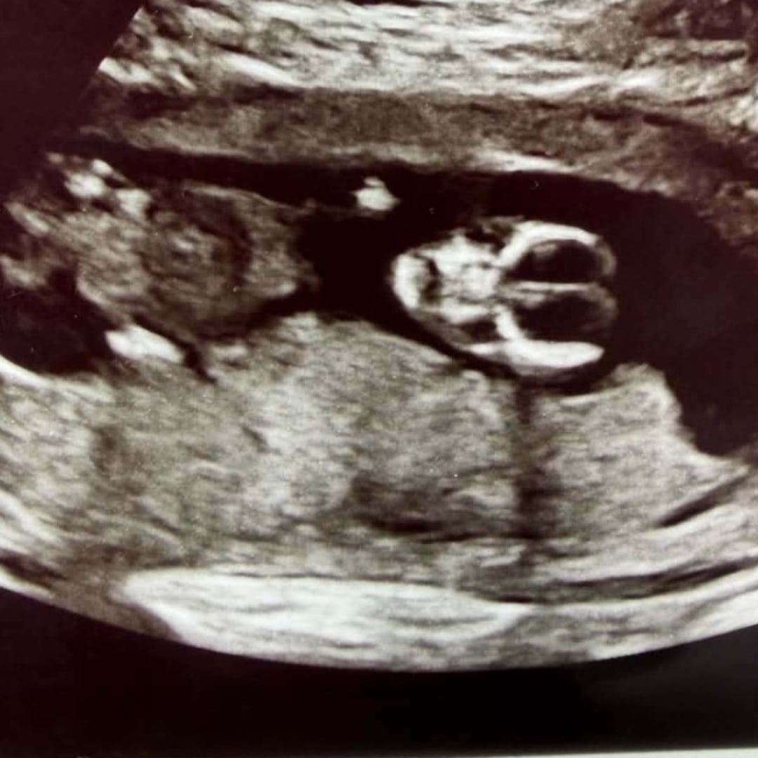 Photo shared by Cassandra for their Babylist baby registry.