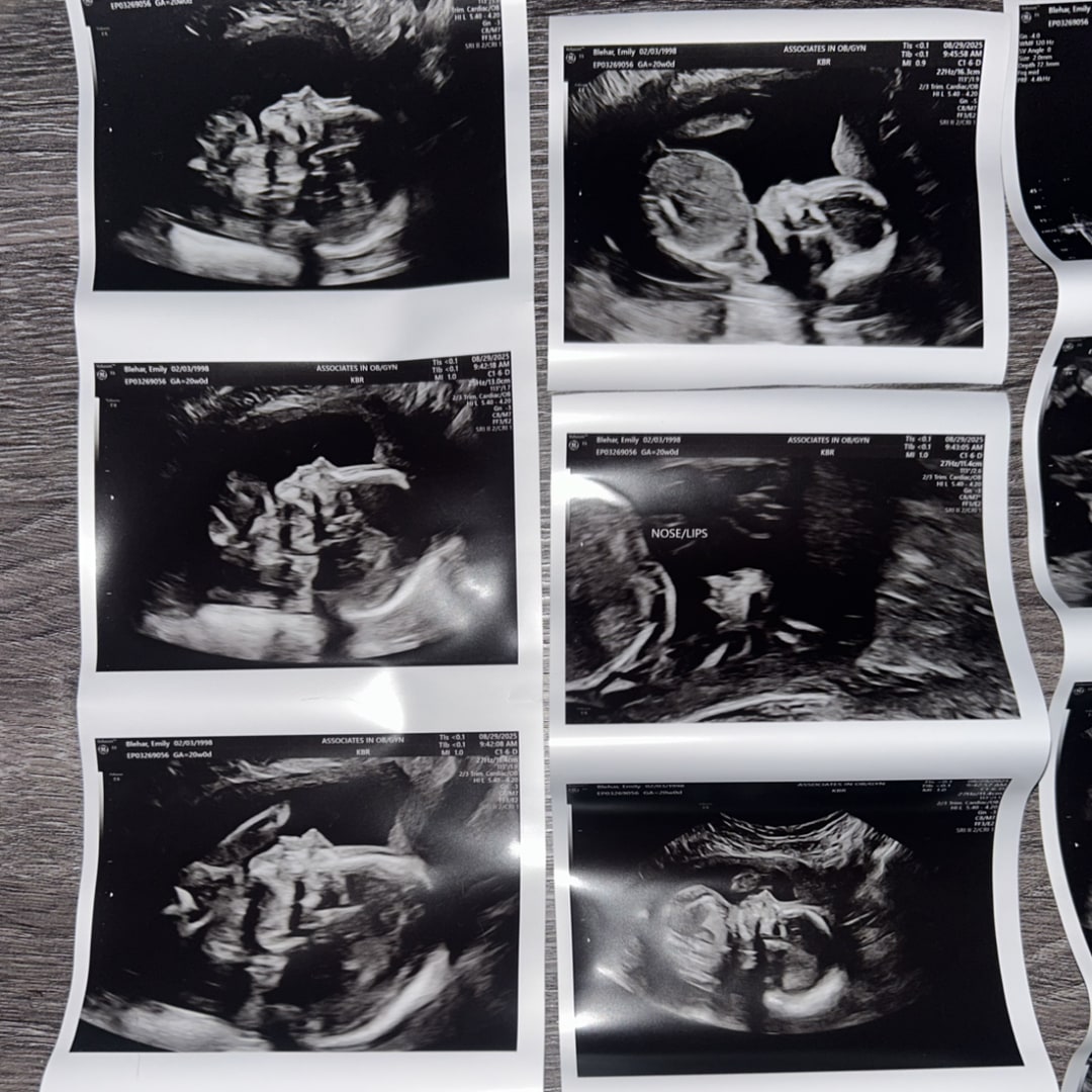 Photo shared by Emily for their Babylist baby registry.