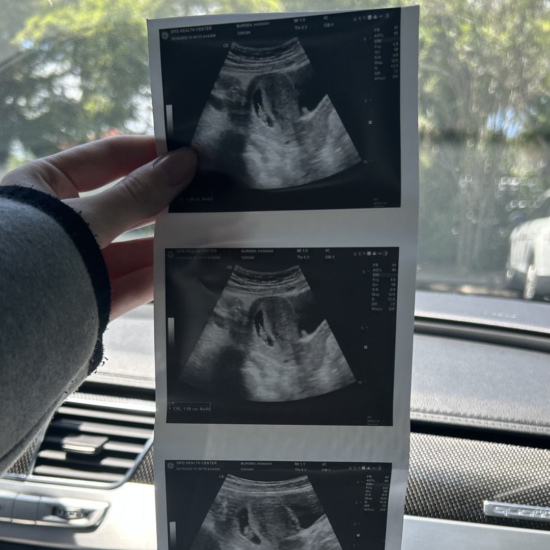 Photo shared by Hannah for their Babylist baby registry.
