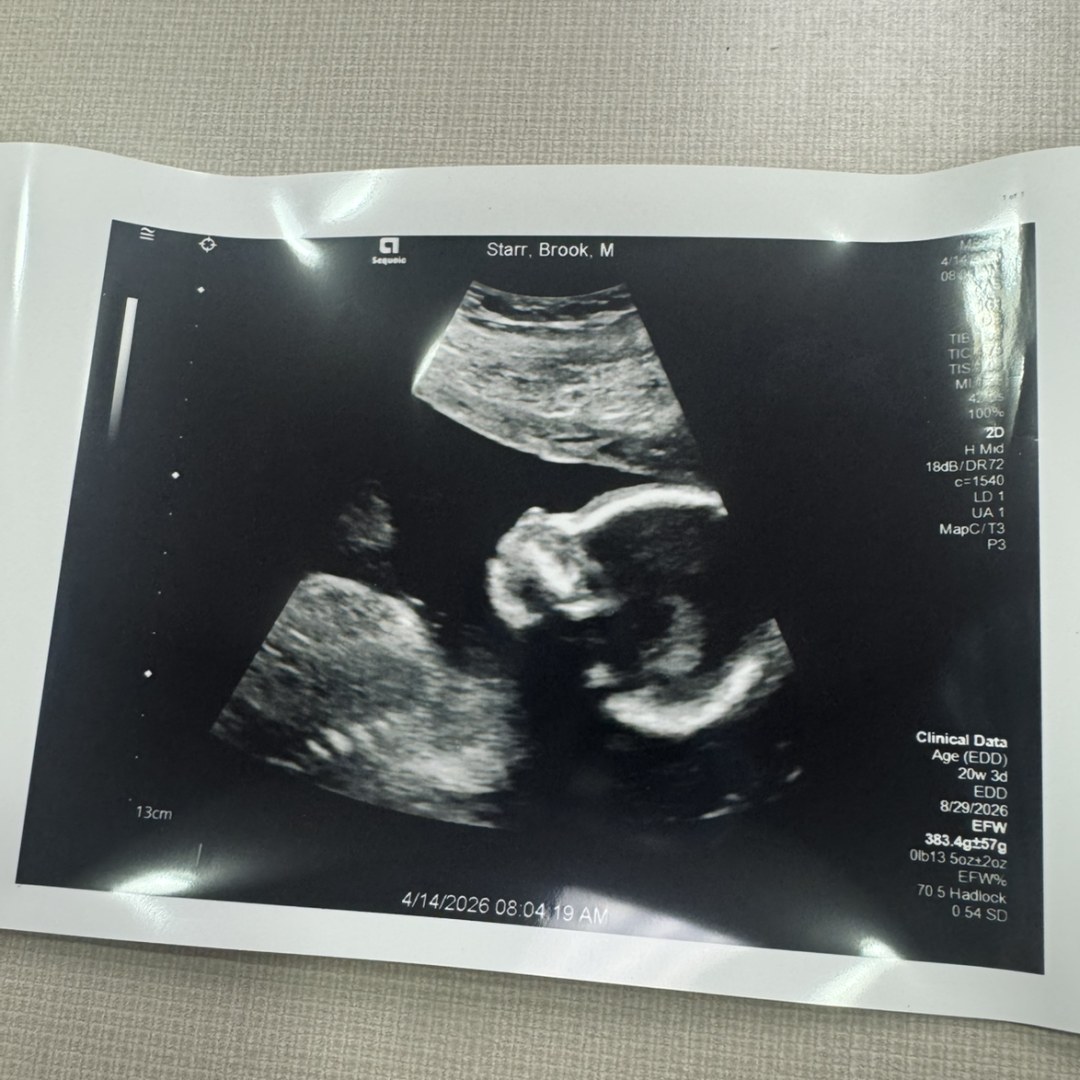 Photo shared by Brook for their Babylist baby registry.