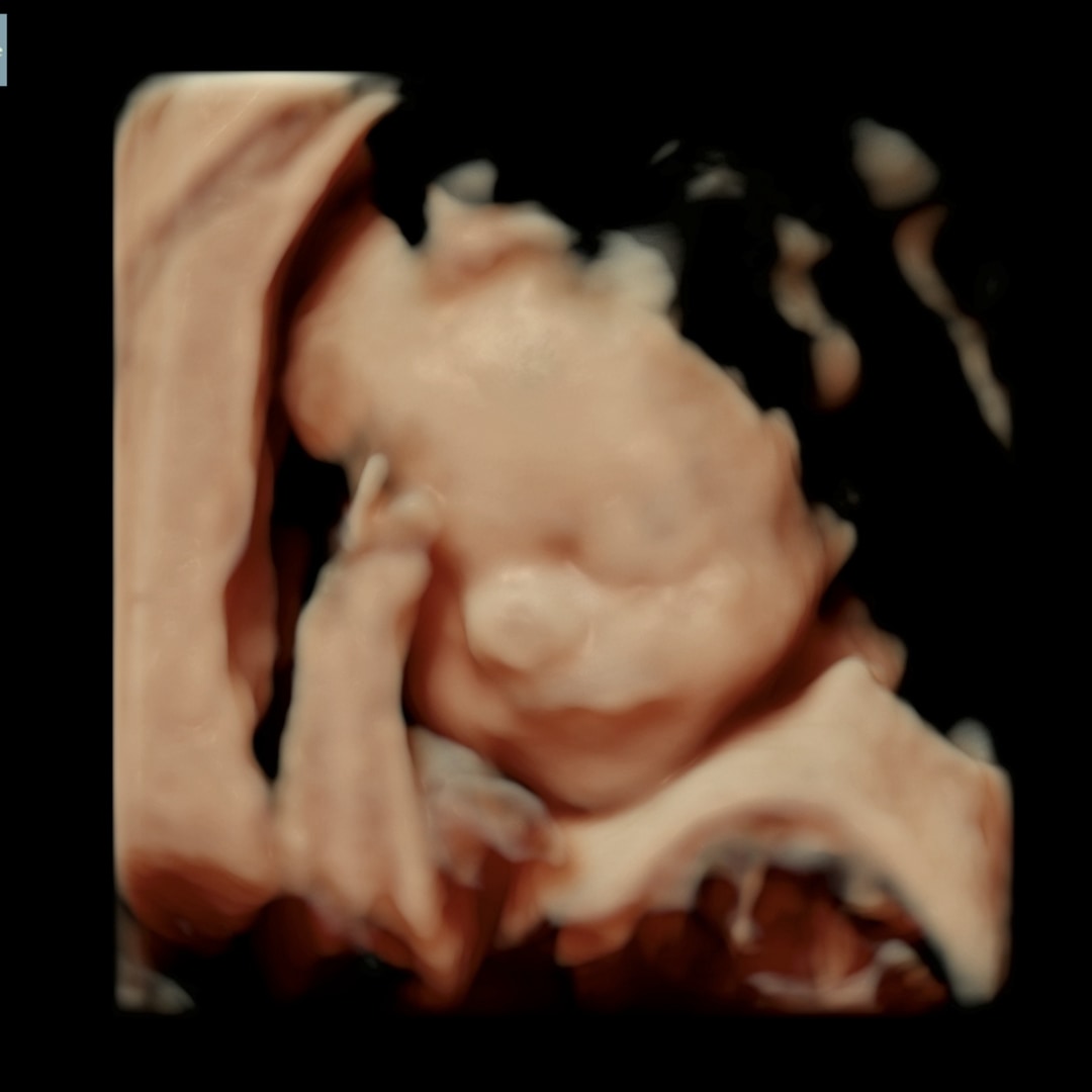 Photo shared by Emily for their Babylist baby registry.