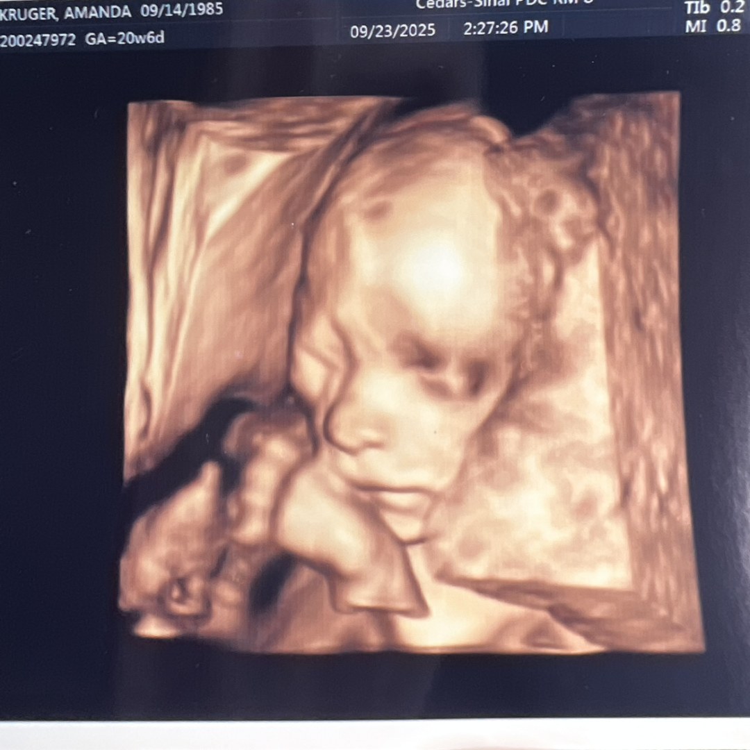 Photo shared by Amanda for their Babylist baby registry.