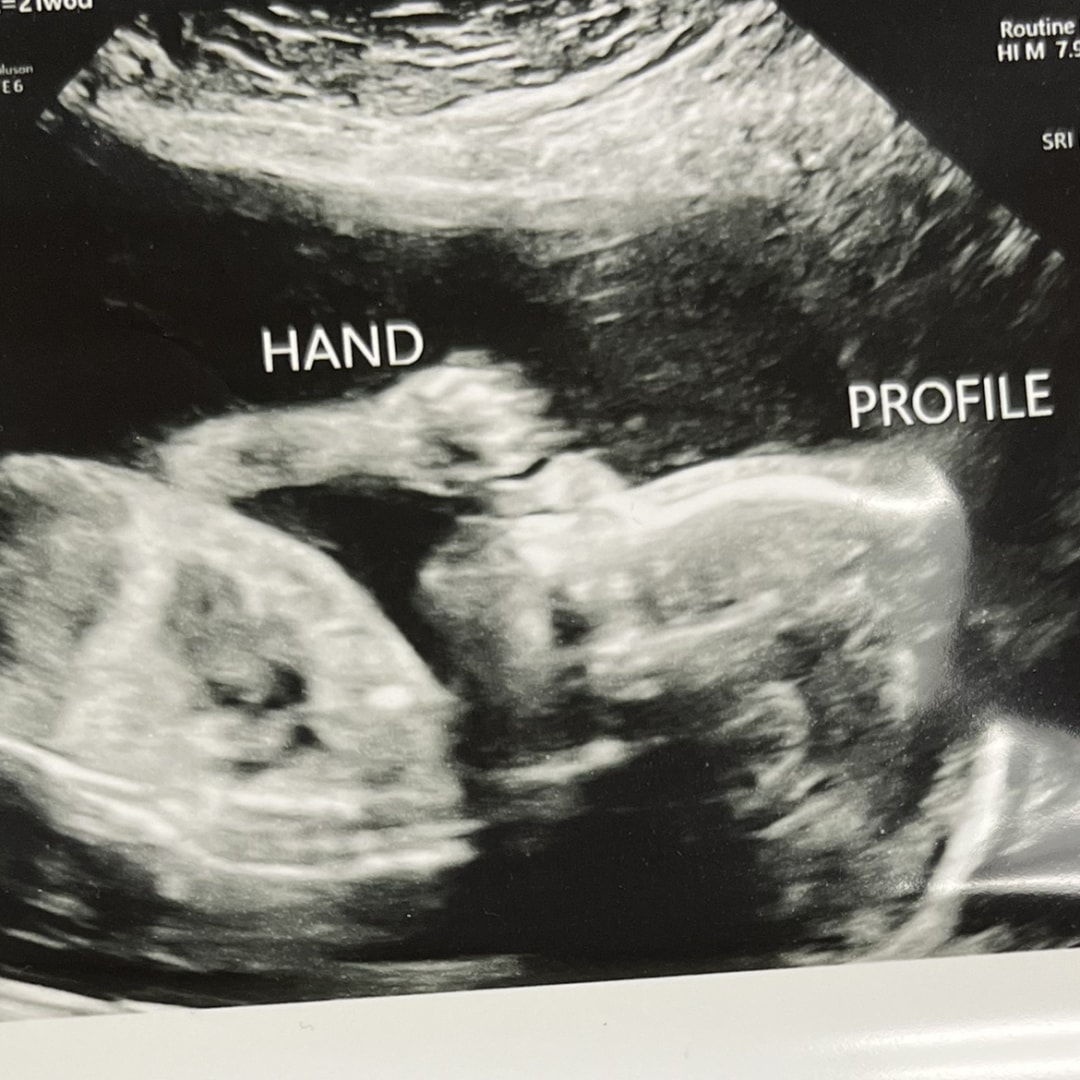 Photo shared by Amy for their Babylist baby registry.