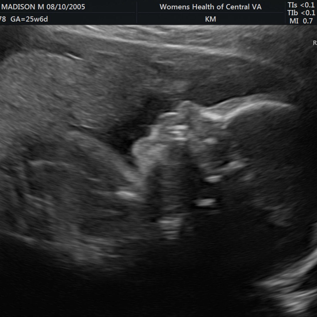 Photo shared by Maddie for their Babylist baby registry.