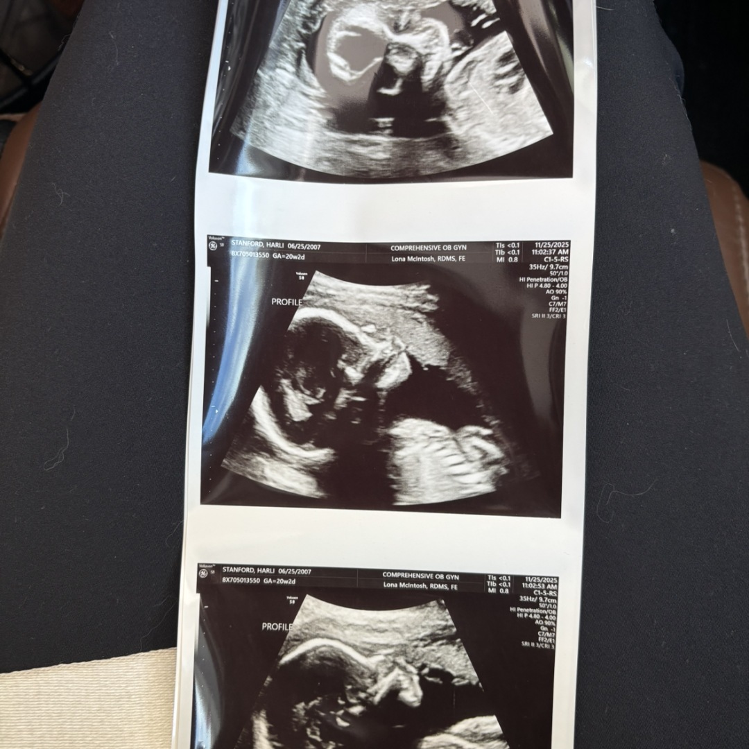 Photo shared by Harli for their Babylist baby registry.