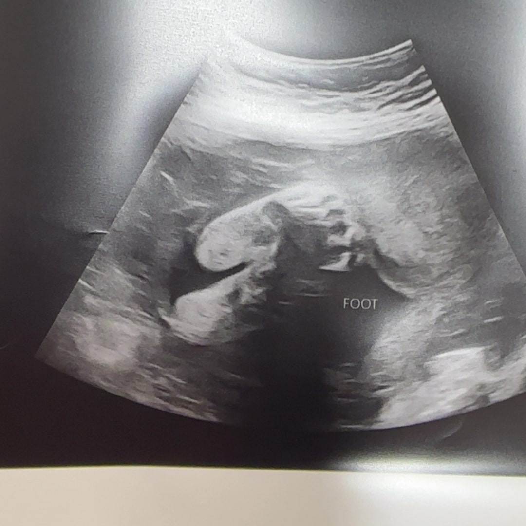 Photo shared by Elizabeth for their Babylist baby registry.