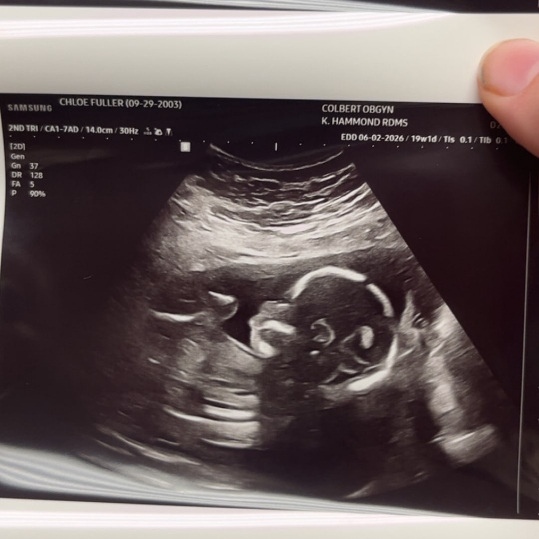 Photo shared by Chloe for their Babylist baby registry.