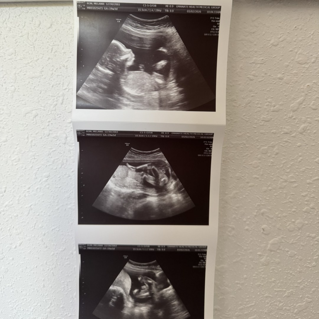 Photo shared by Melanie for their Babylist baby registry.