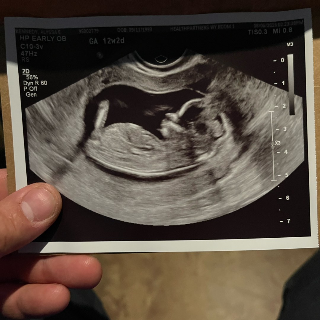 Photo shared by Alyssa for their Babylist baby registry.