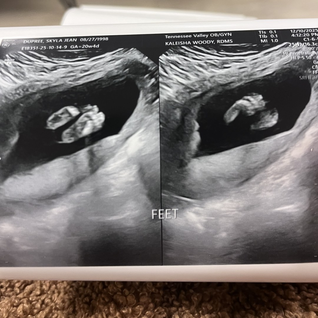 Photo shared by Skyla for their Babylist baby registry.