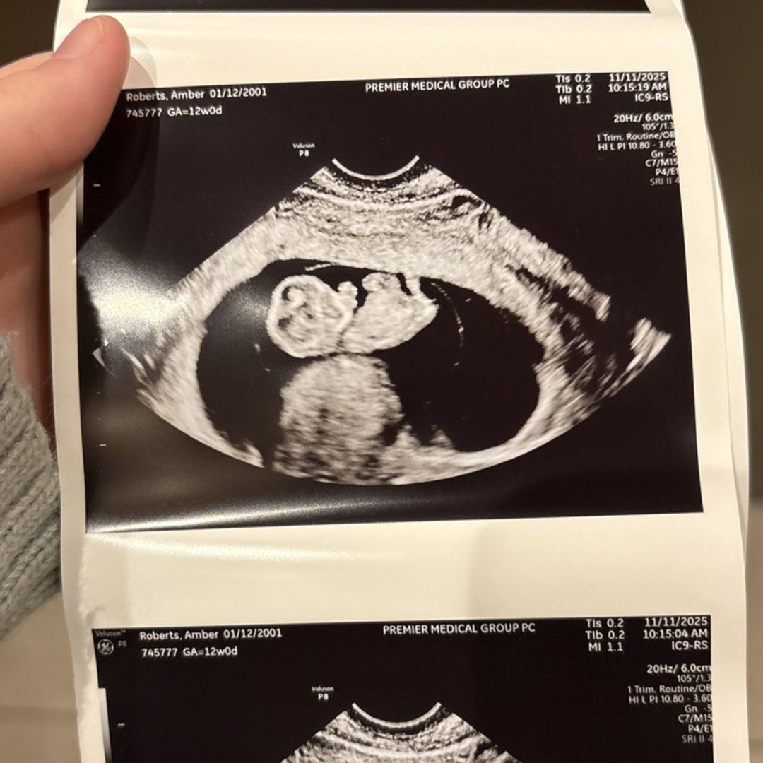 Photo shared by Amber for their Babylist baby registry.