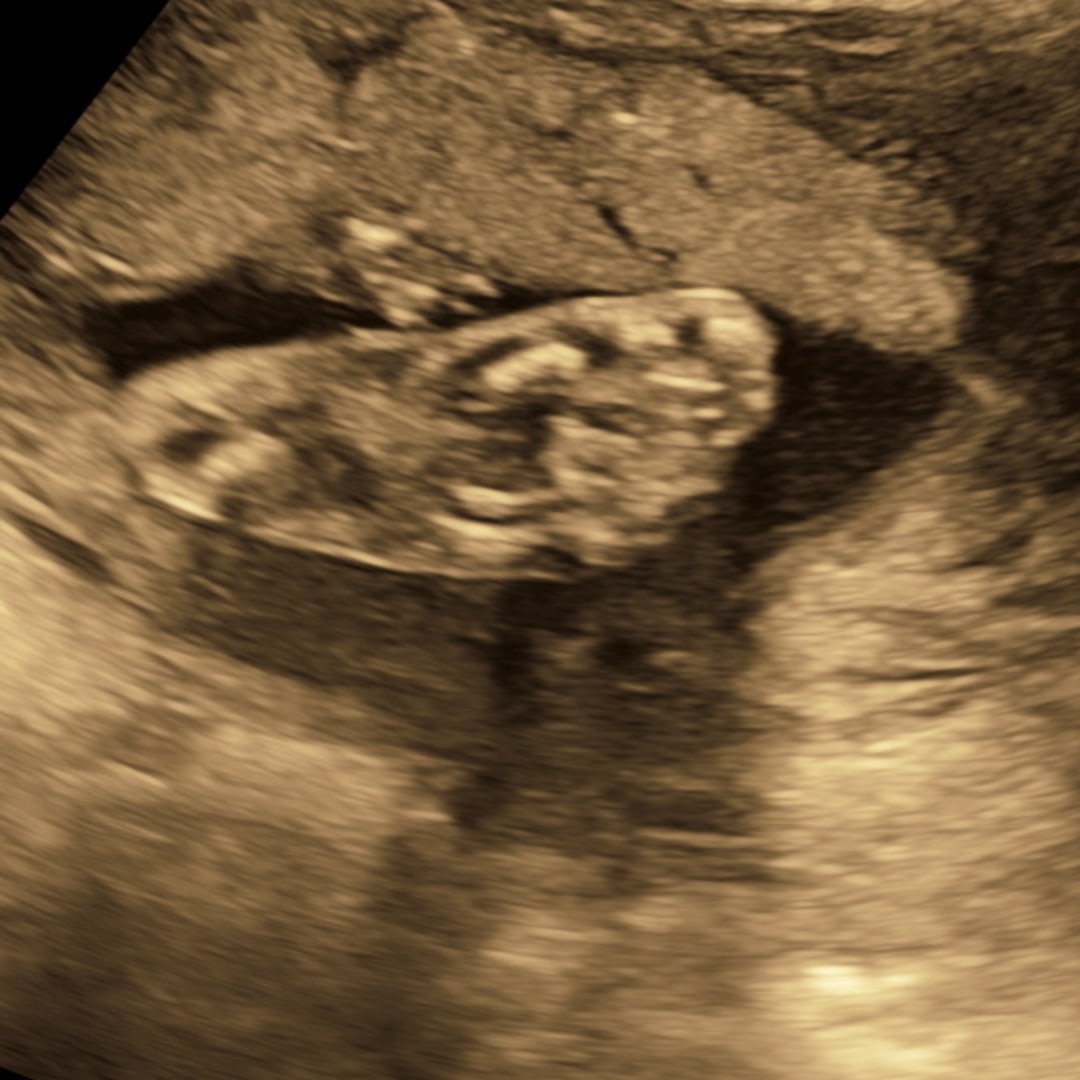 Photo shared by Catherine for their Babylist baby registry.