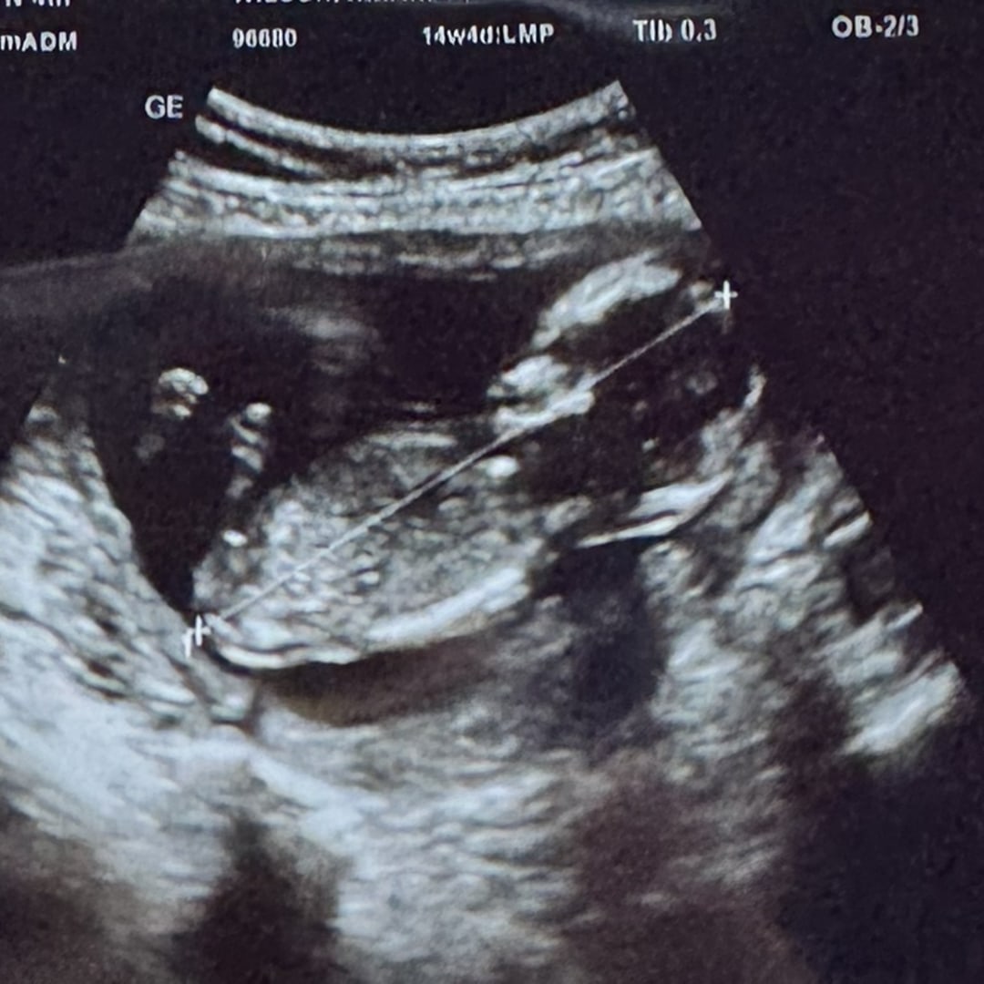 Photo shared by Rhiannon for their Babylist baby registry.