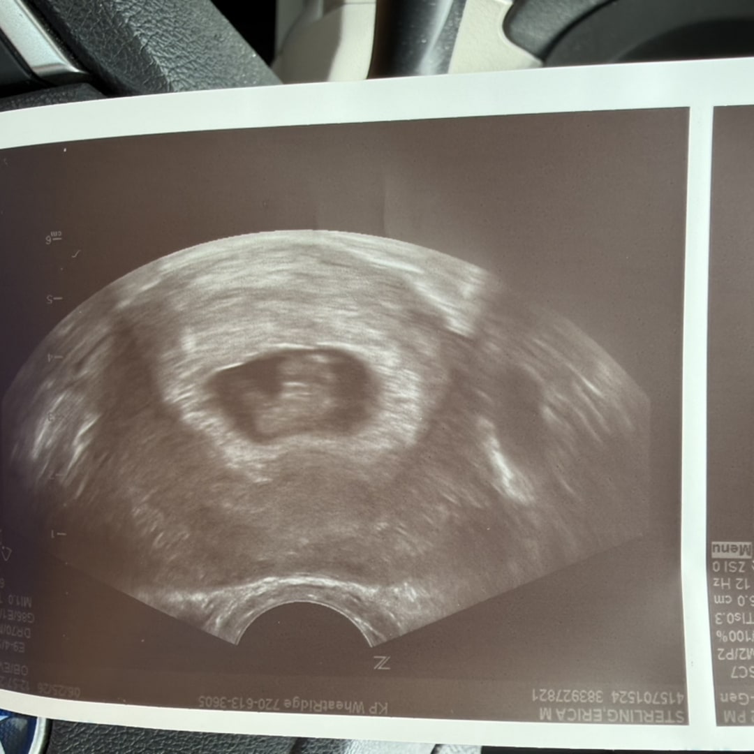 Photo shared by Erica for their Babylist baby registry.