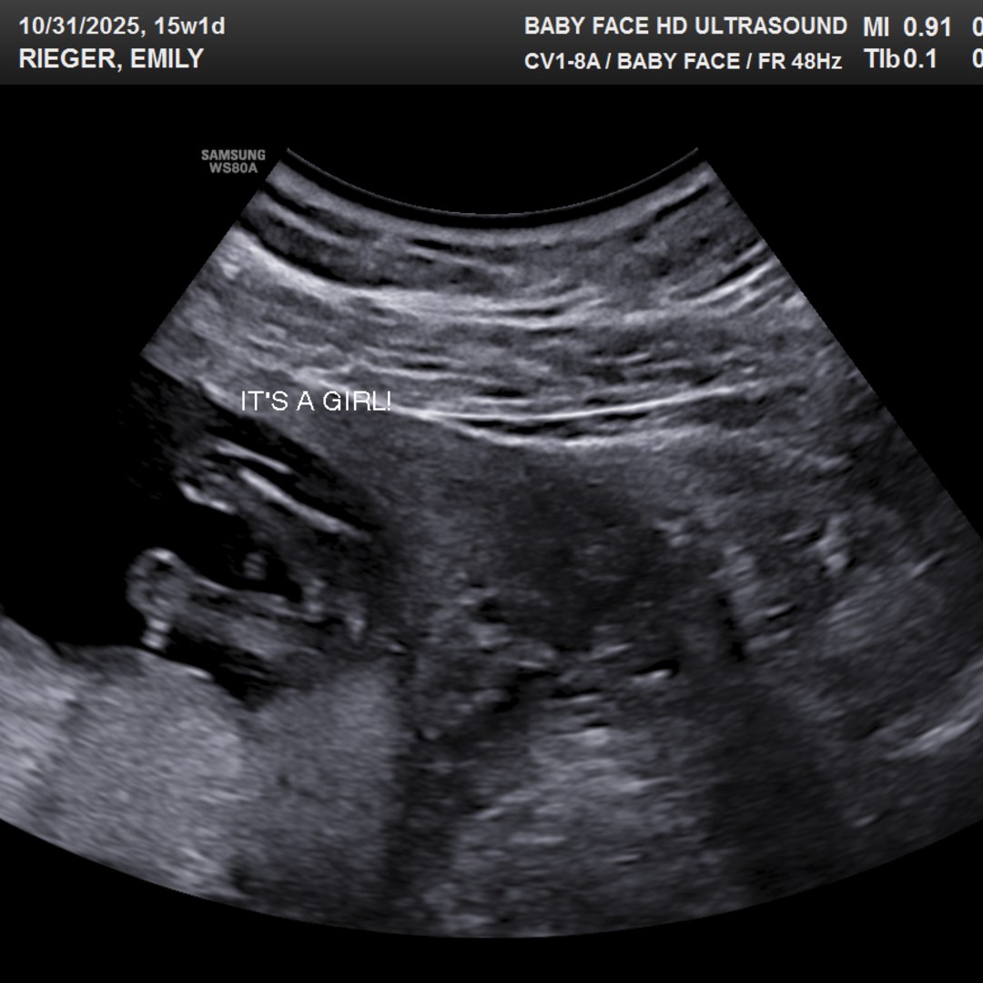 Photo shared by Emily for their Babylist baby registry.
