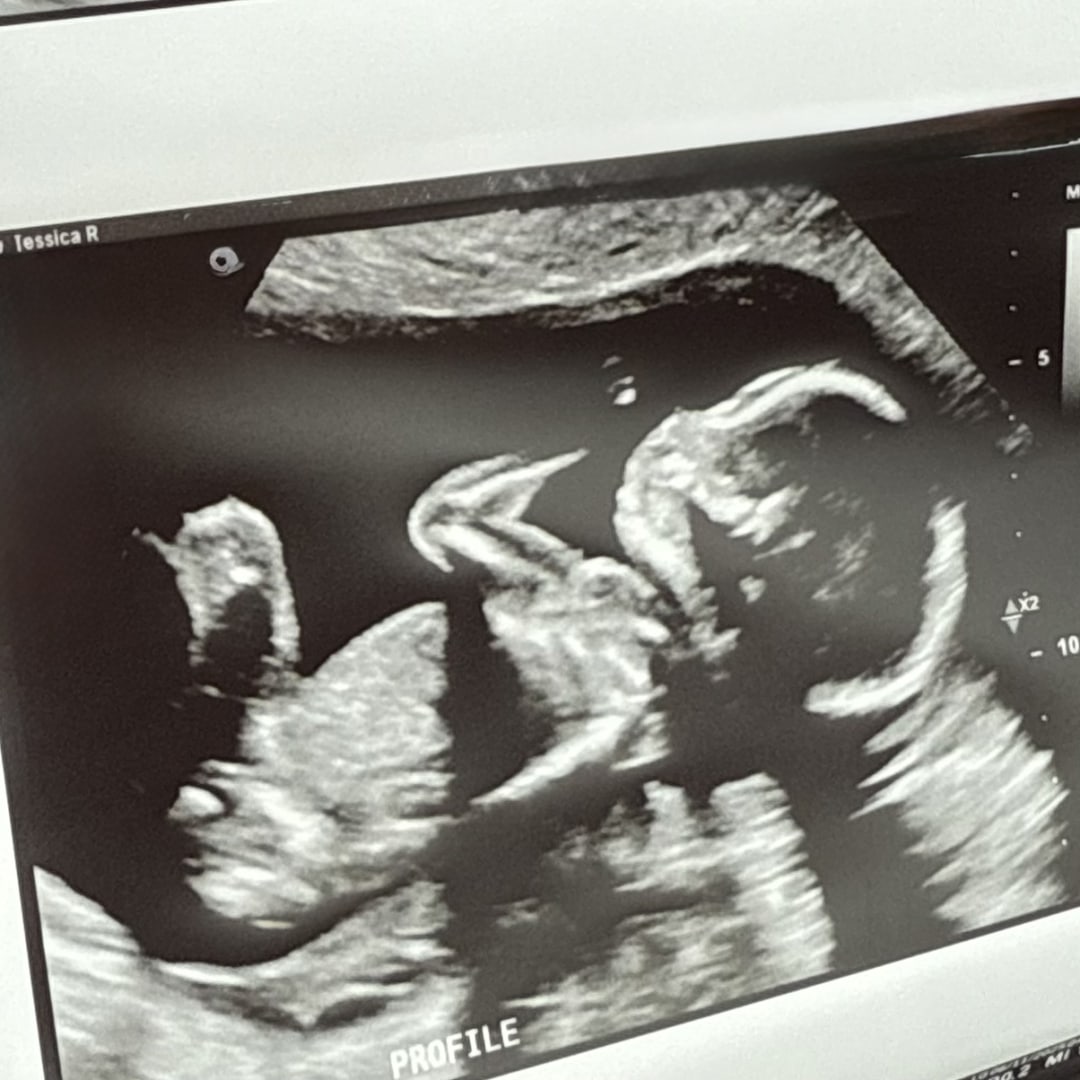 Photo shared by Jessica for their Babylist baby registry.