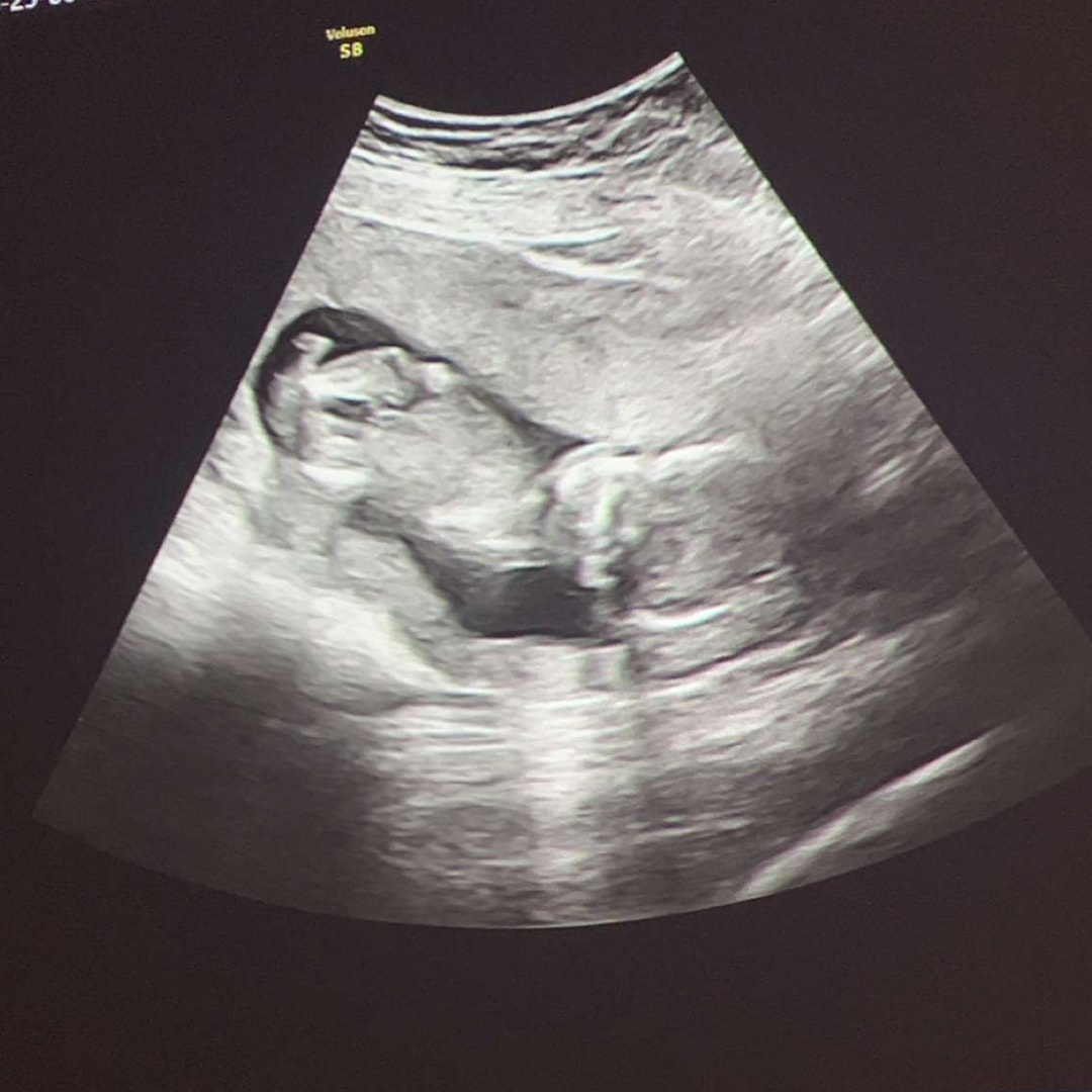 Photo shared by Ellie for their Babylist baby registry.