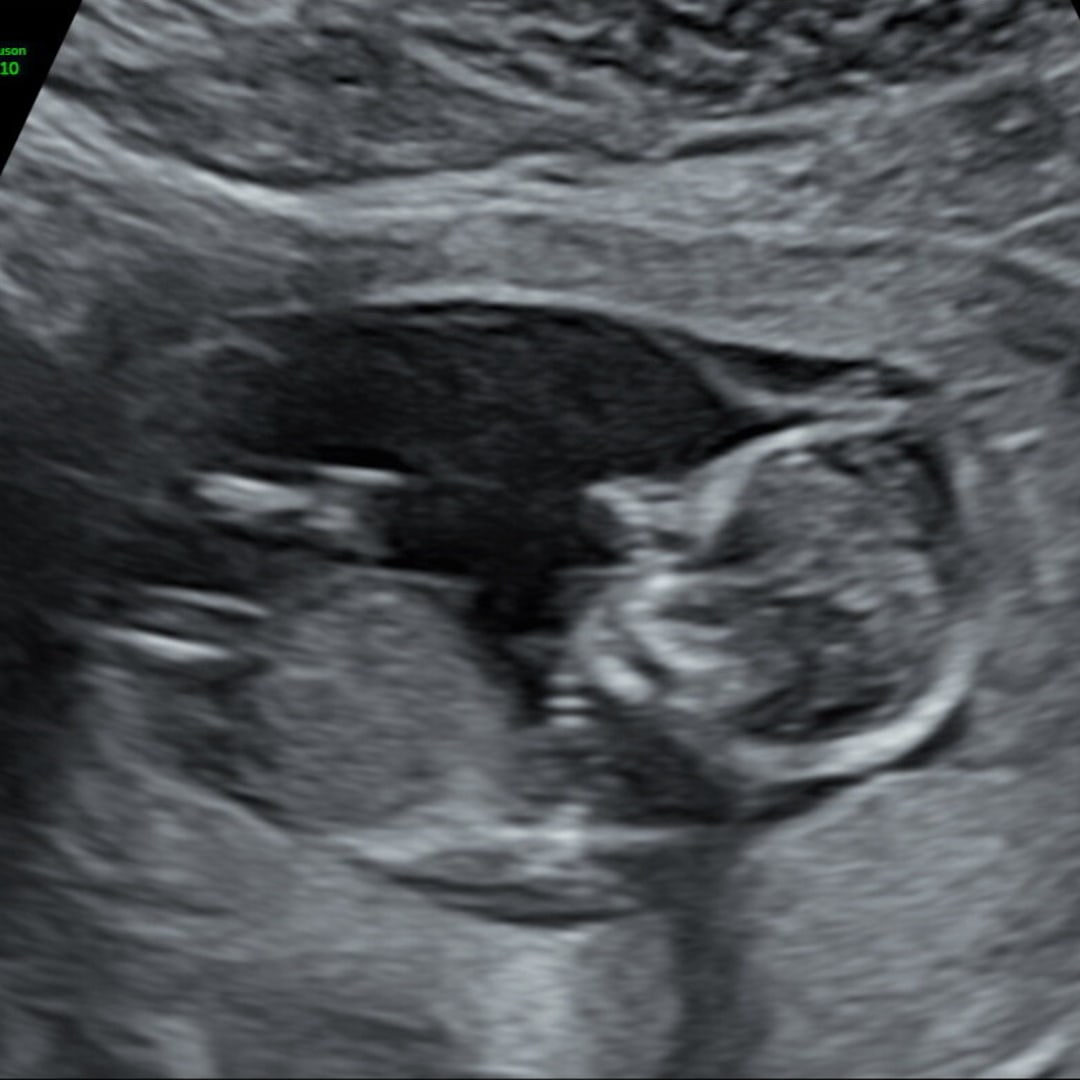 Photo shared by Kate for their Babylist baby registry.