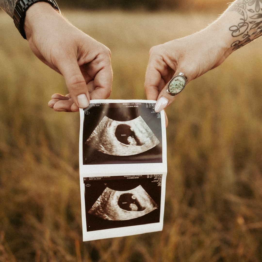 Photo shared by Rhiannon for their Babylist baby registry.