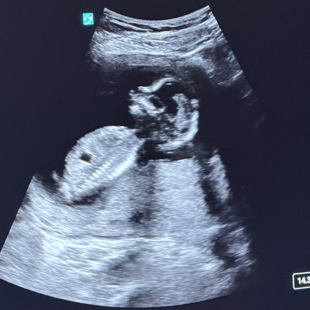 Photo shared by Bryanna for their Babylist baby registry.