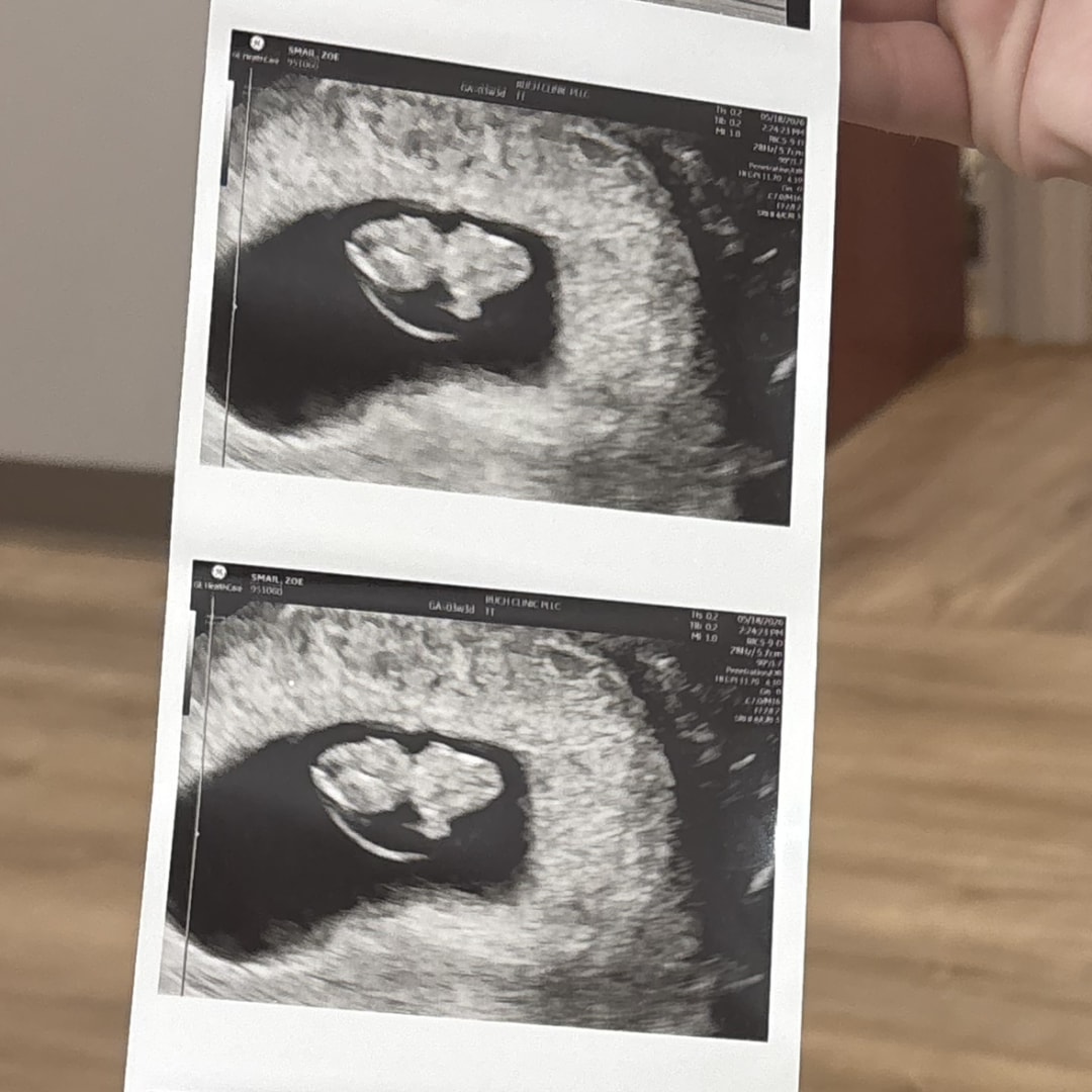 Photo shared by Zoe for their Babylist baby registry.