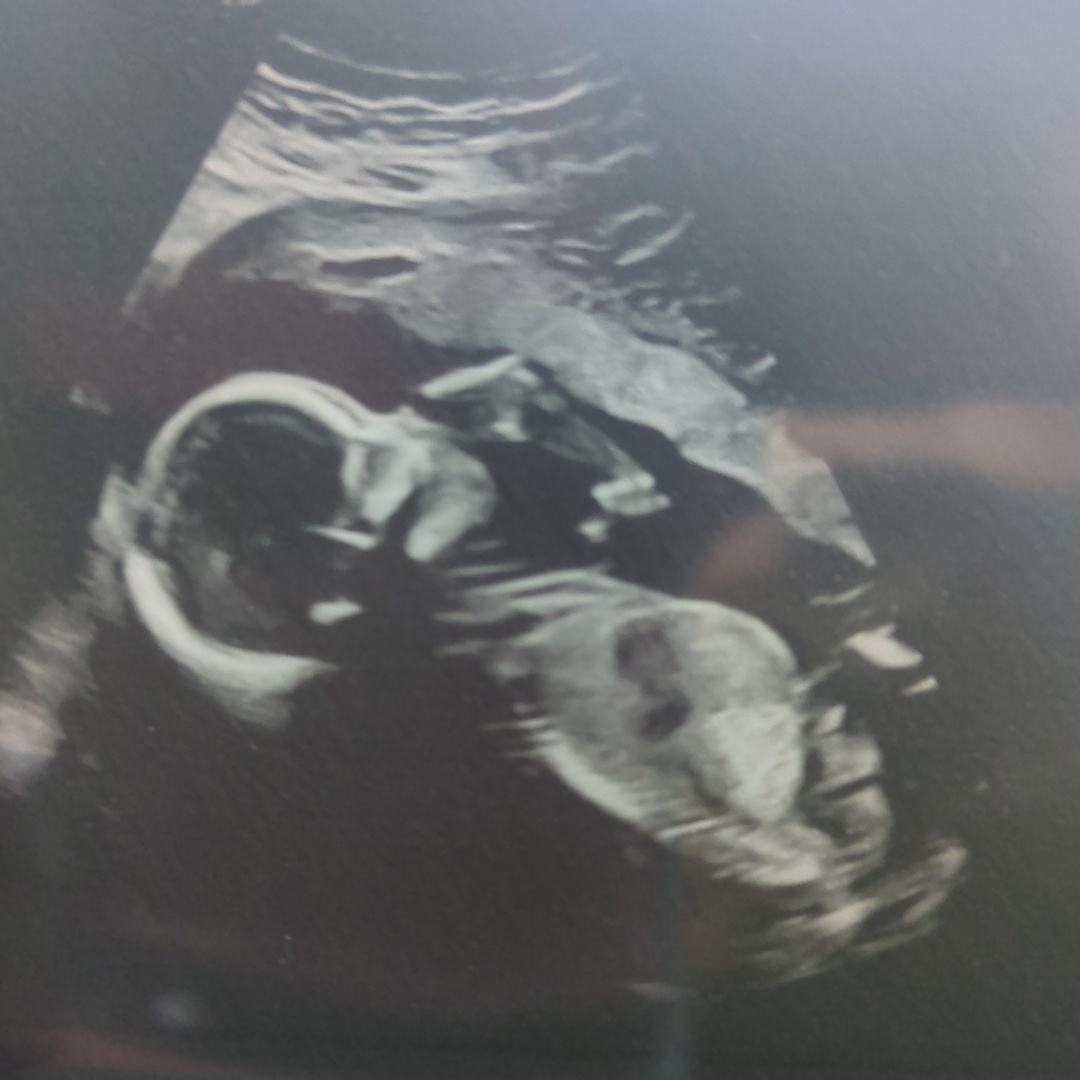 Photo shared by Megan for their Babylist baby registry.