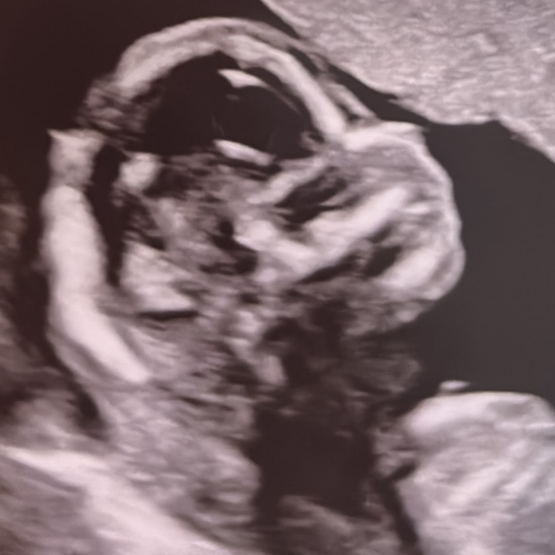 Photo shared by Collisa for their Babylist baby registry.