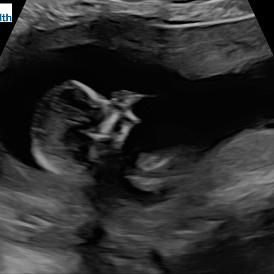 Photo shared by Hannah for their Babylist baby registry.