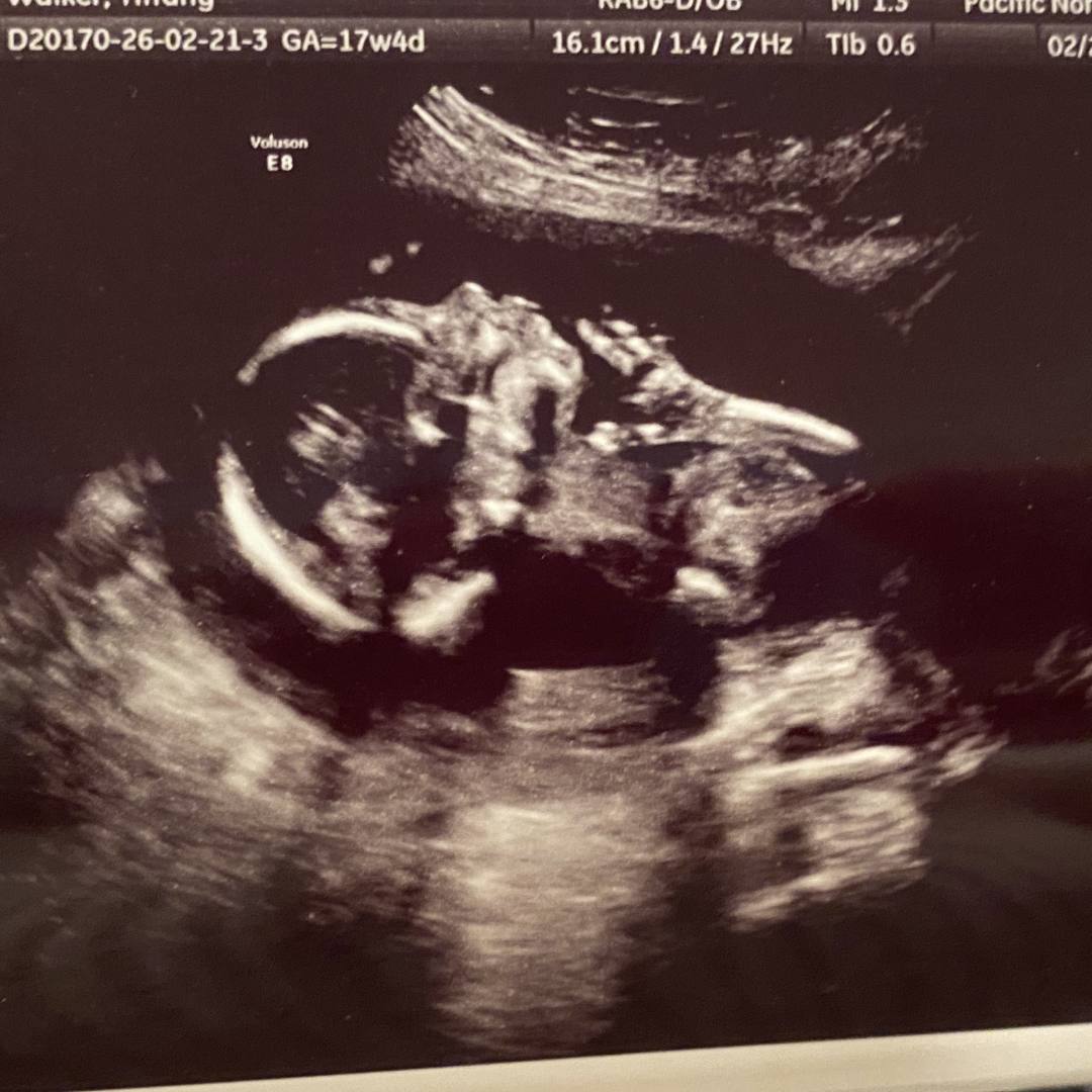 Photo shared by Tiffany for their Babylist baby registry.