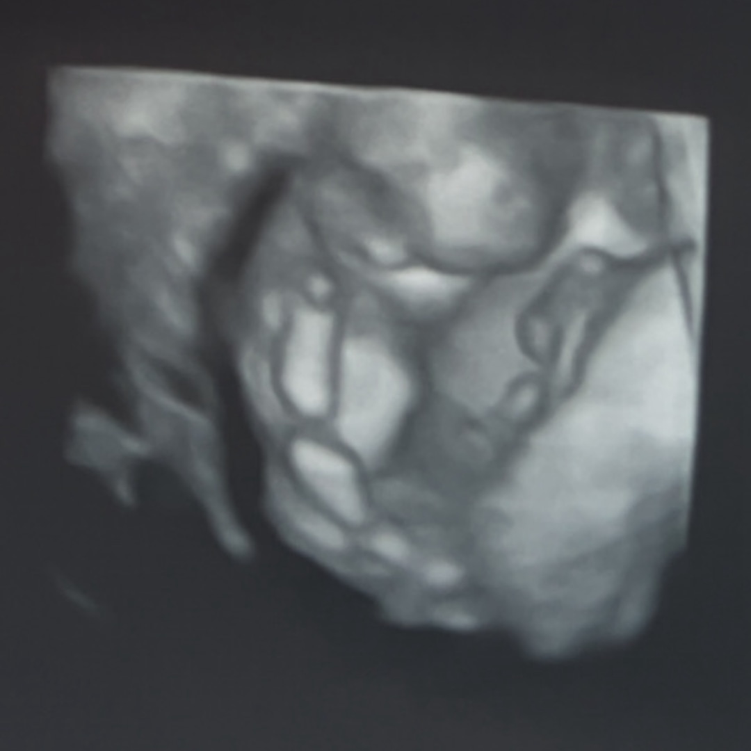 Photo shared by Gabriela for their Babylist baby registry.