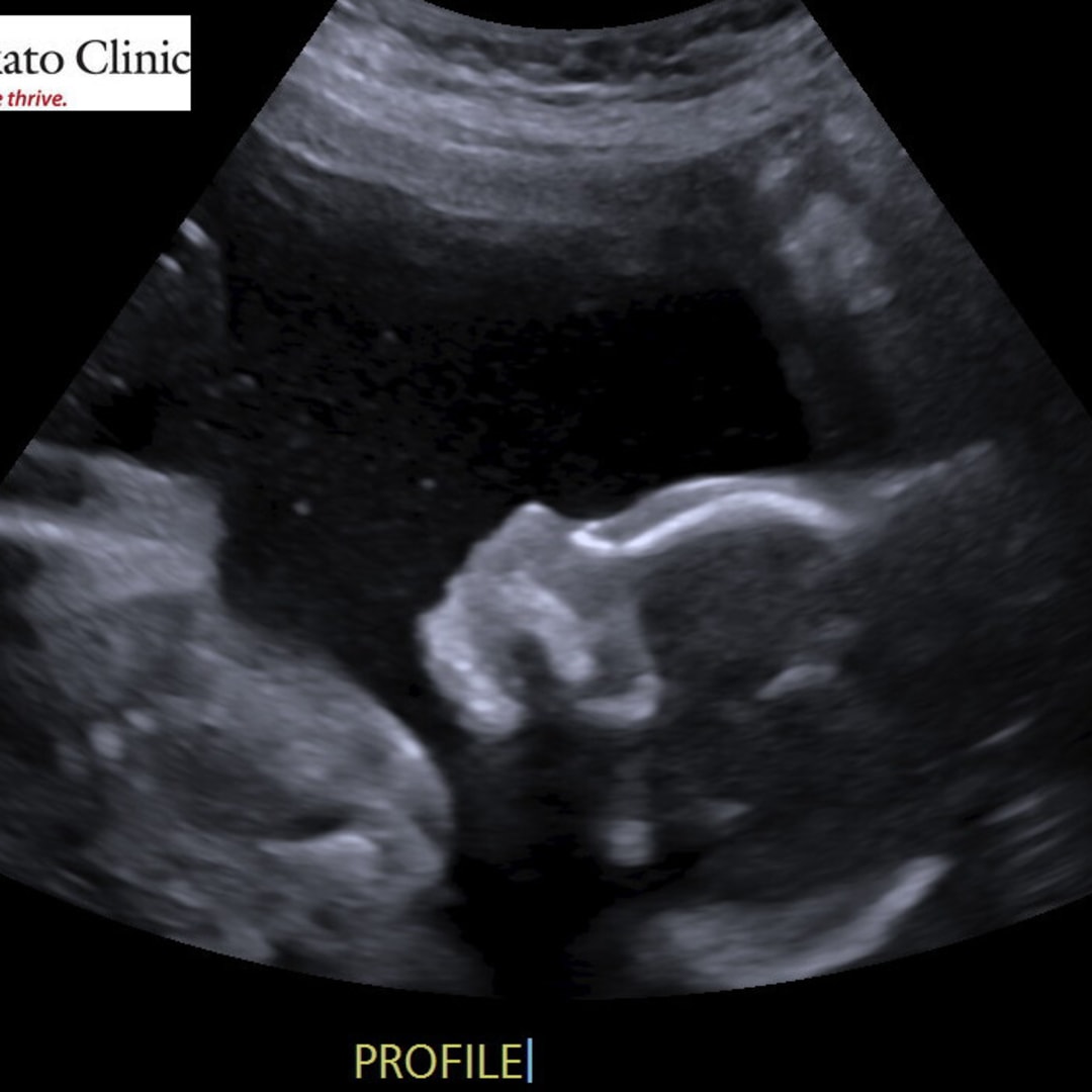 Photo shared by Ruby for their Babylist baby registry.