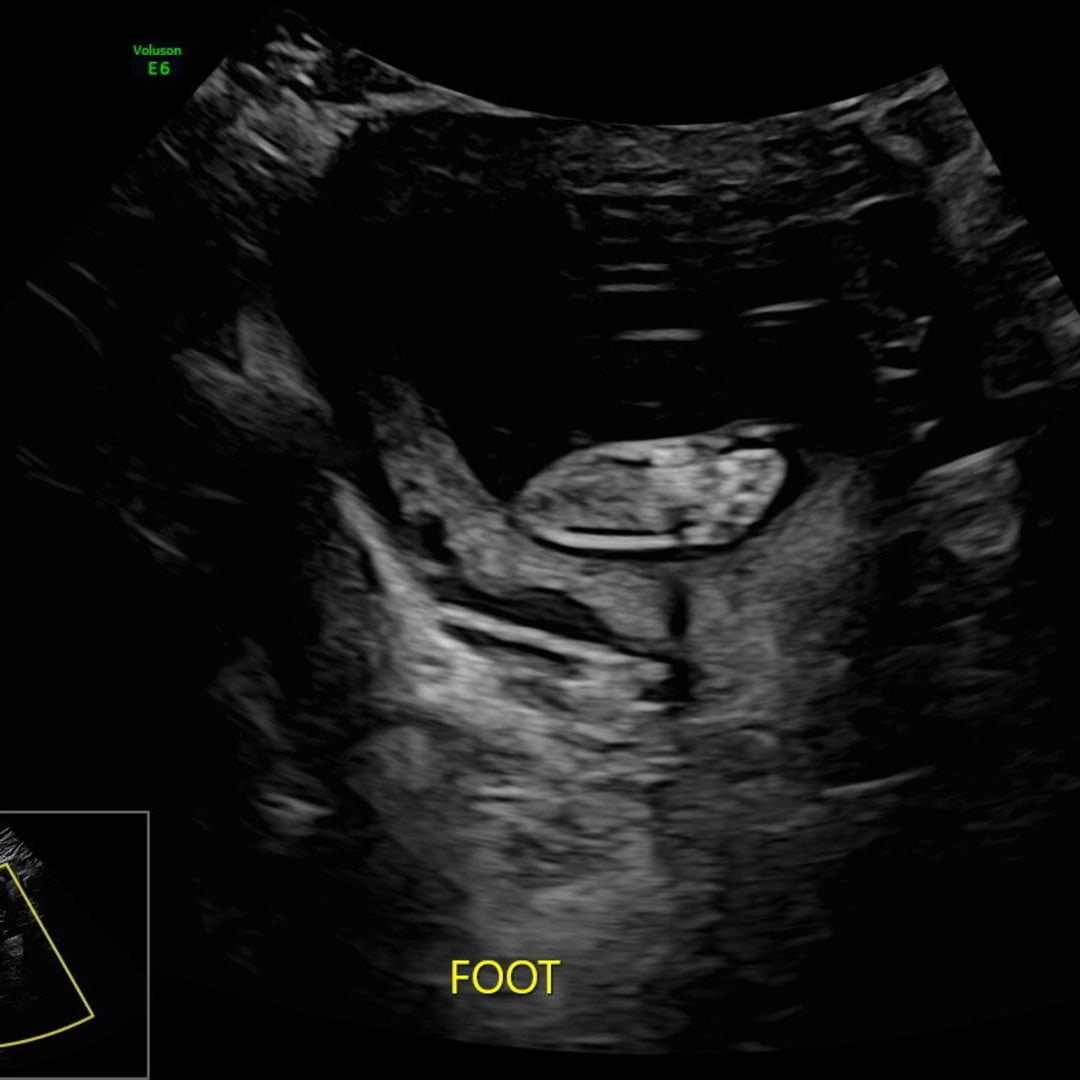 Photo shared by Madelyn for their Babylist baby registry.