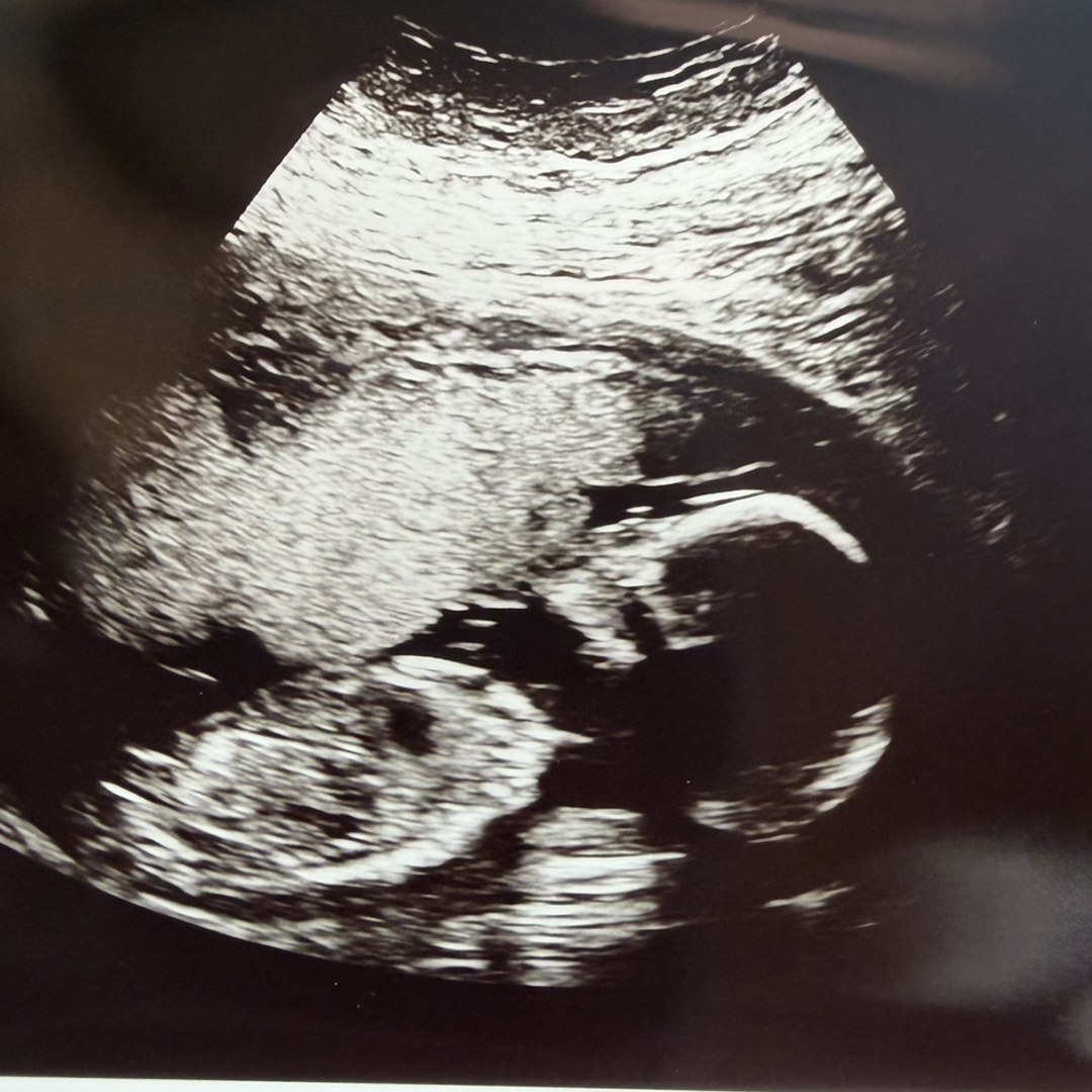 Photo shared by Chellsey for their Babylist baby registry.