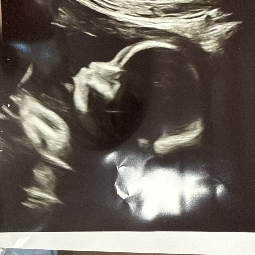 Photo shared by Destinee for their Babylist baby registry.