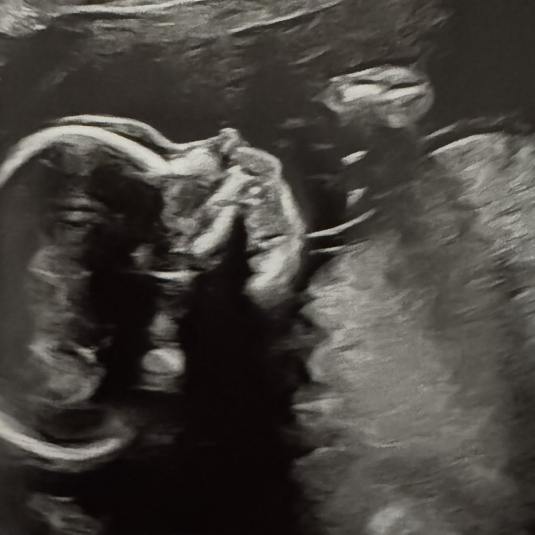 Photo shared by Kimberly for their Babylist baby registry.