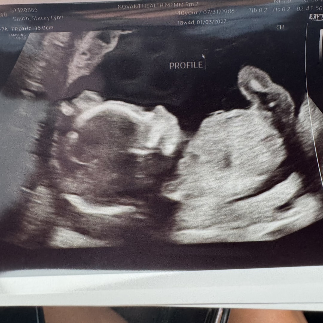 Photo shared by Stacey for their Babylist baby registry.
