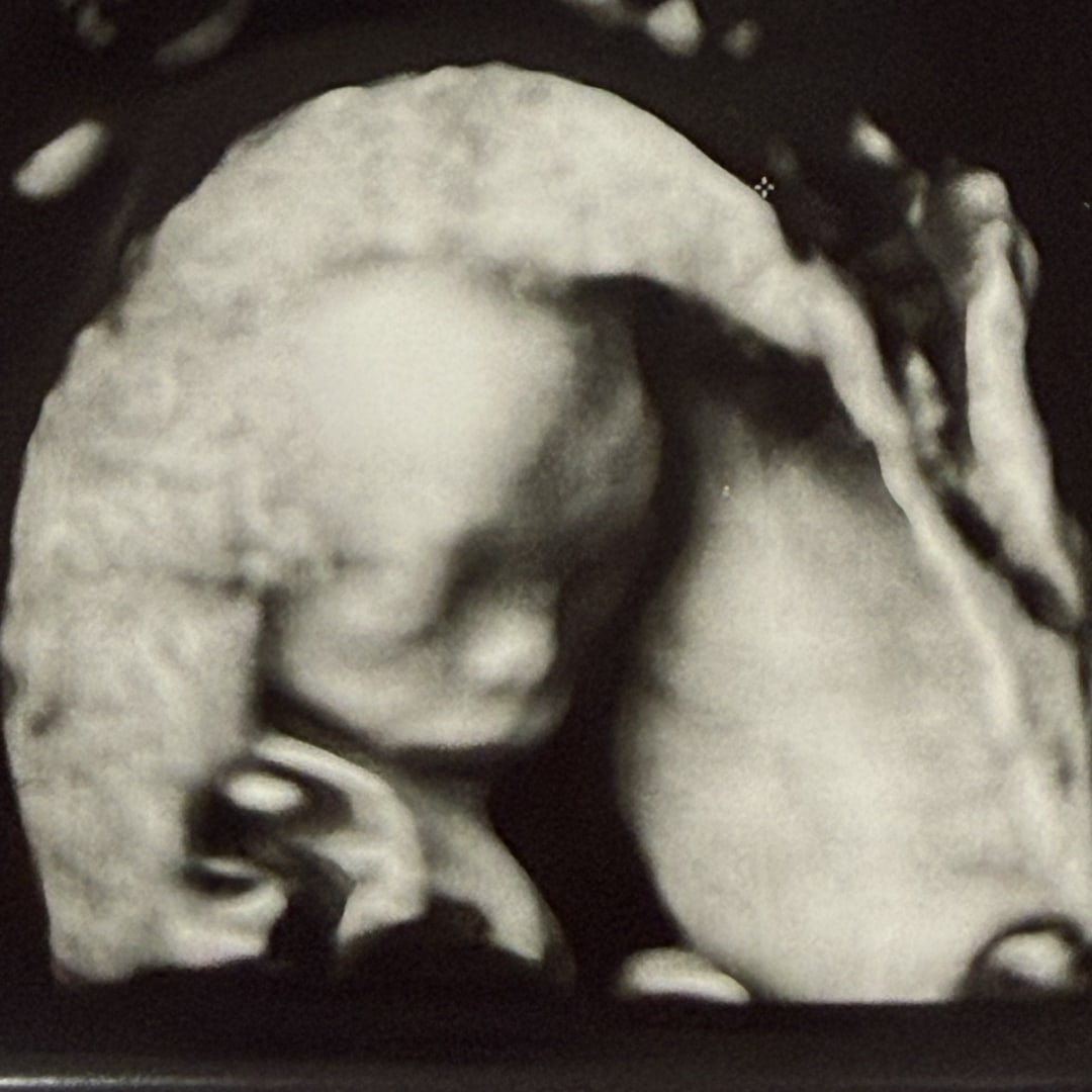 Photo shared by Mary Grace for their Babylist baby registry.