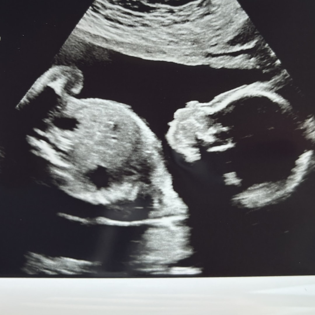 Photo shared by Morgan for their Babylist baby registry.