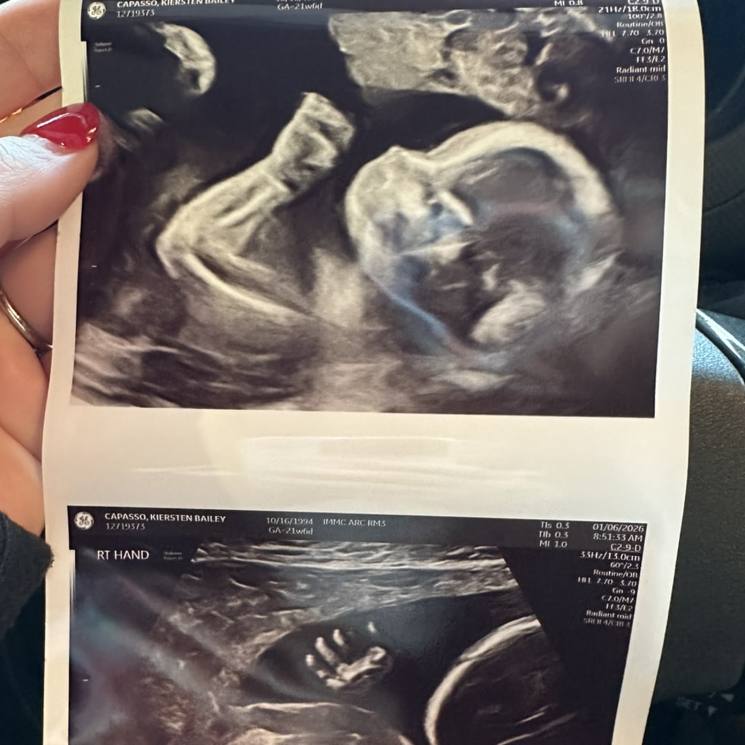 Photo shared by Kiersten for their Babylist baby registry.