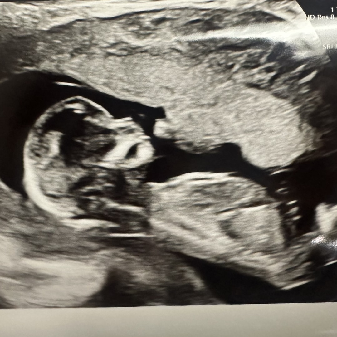 Photo shared by Deserie for their Babylist baby registry.