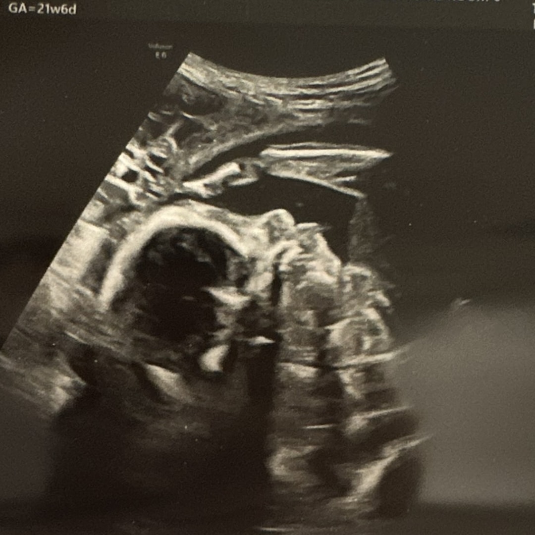 Photo shared by Ro'Shayla for their Babylist baby registry.