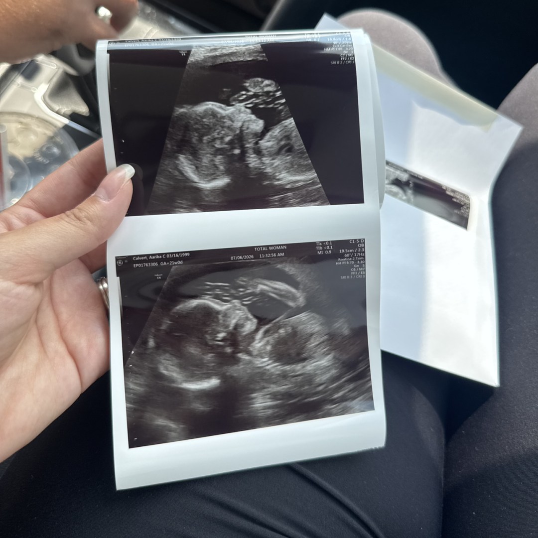 Photo shared by Aarika for their Babylist baby registry.
