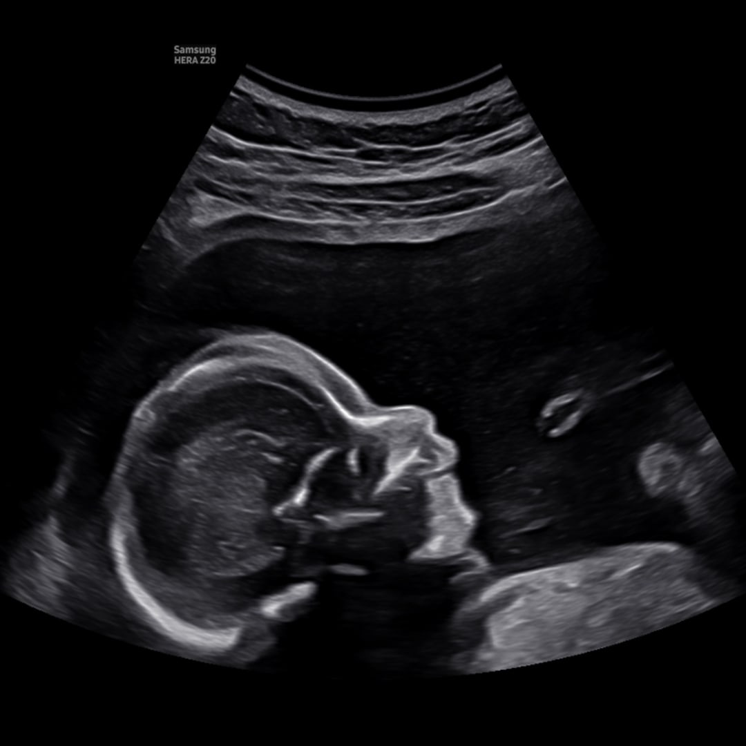 Photo shared by Aliyah for their Babylist baby registry.