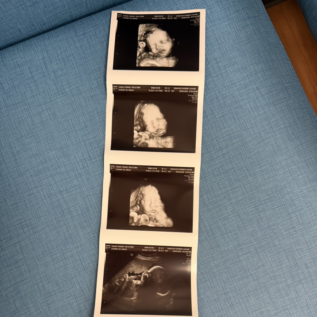 Photo shared by Pionaly for their Babylist baby registry.