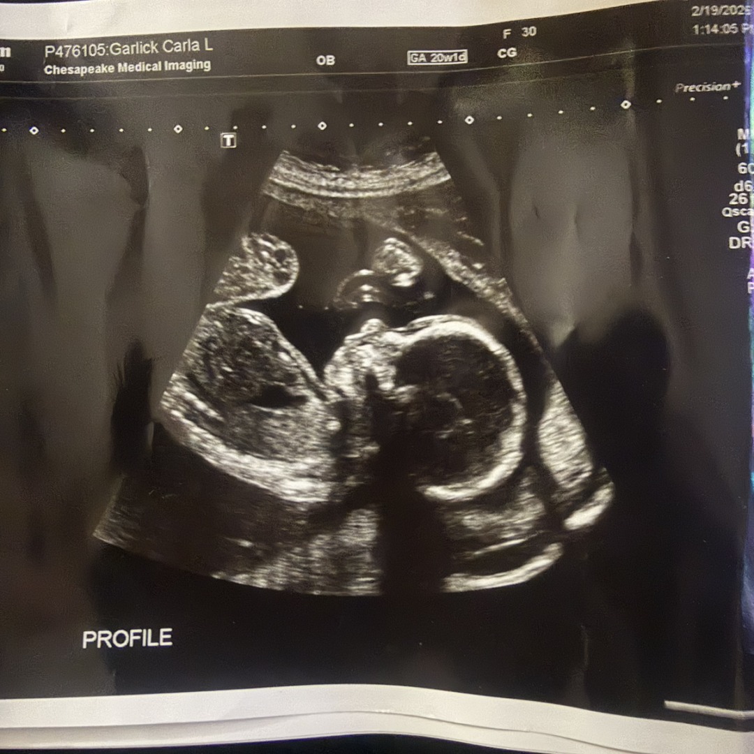 Photo shared by Carla for their Babylist baby registry.