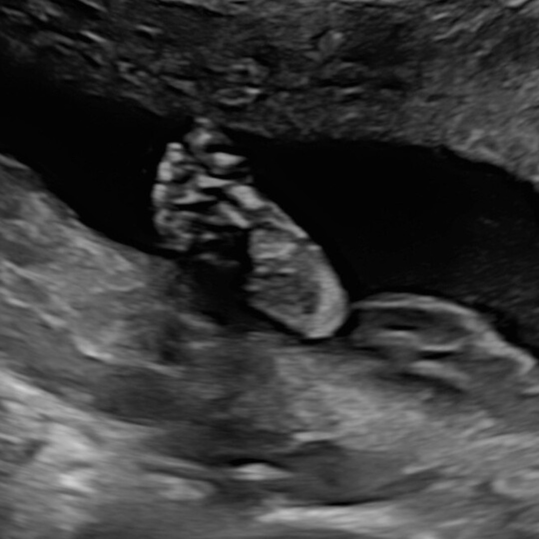 Photo shared by Abigail for their Babylist baby registry.