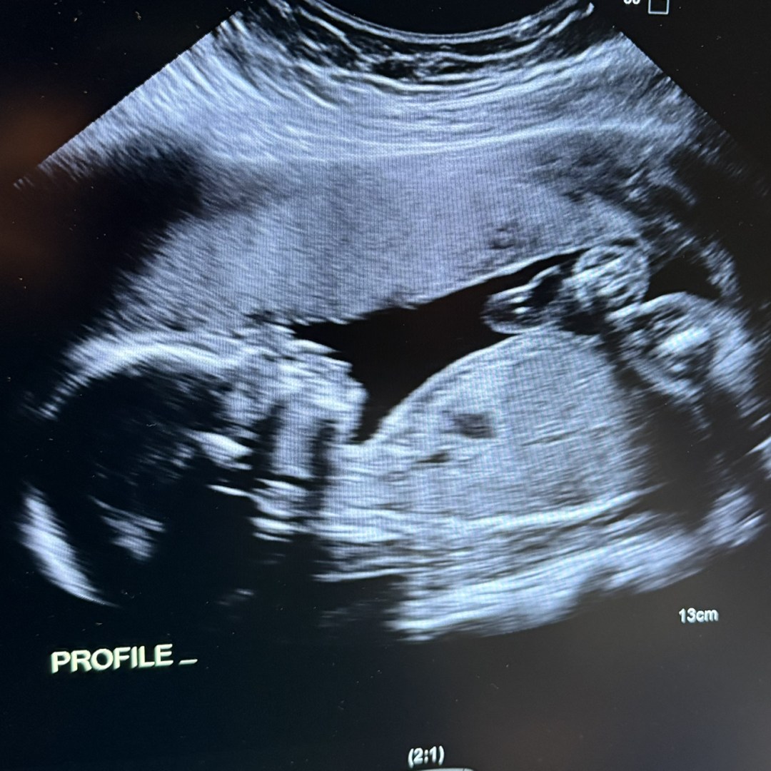 Photo shared by Jacey for their Babylist baby registry.