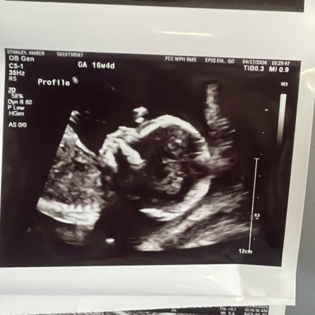 Photo shared by Amber for their Babylist baby registry.