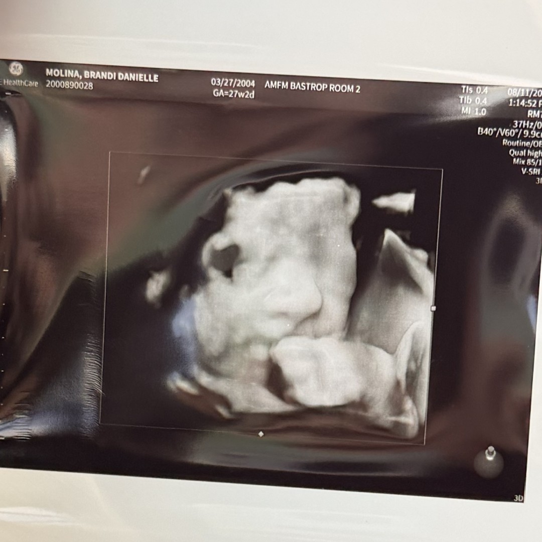 Photo shared by Brandi for their Babylist baby registry.