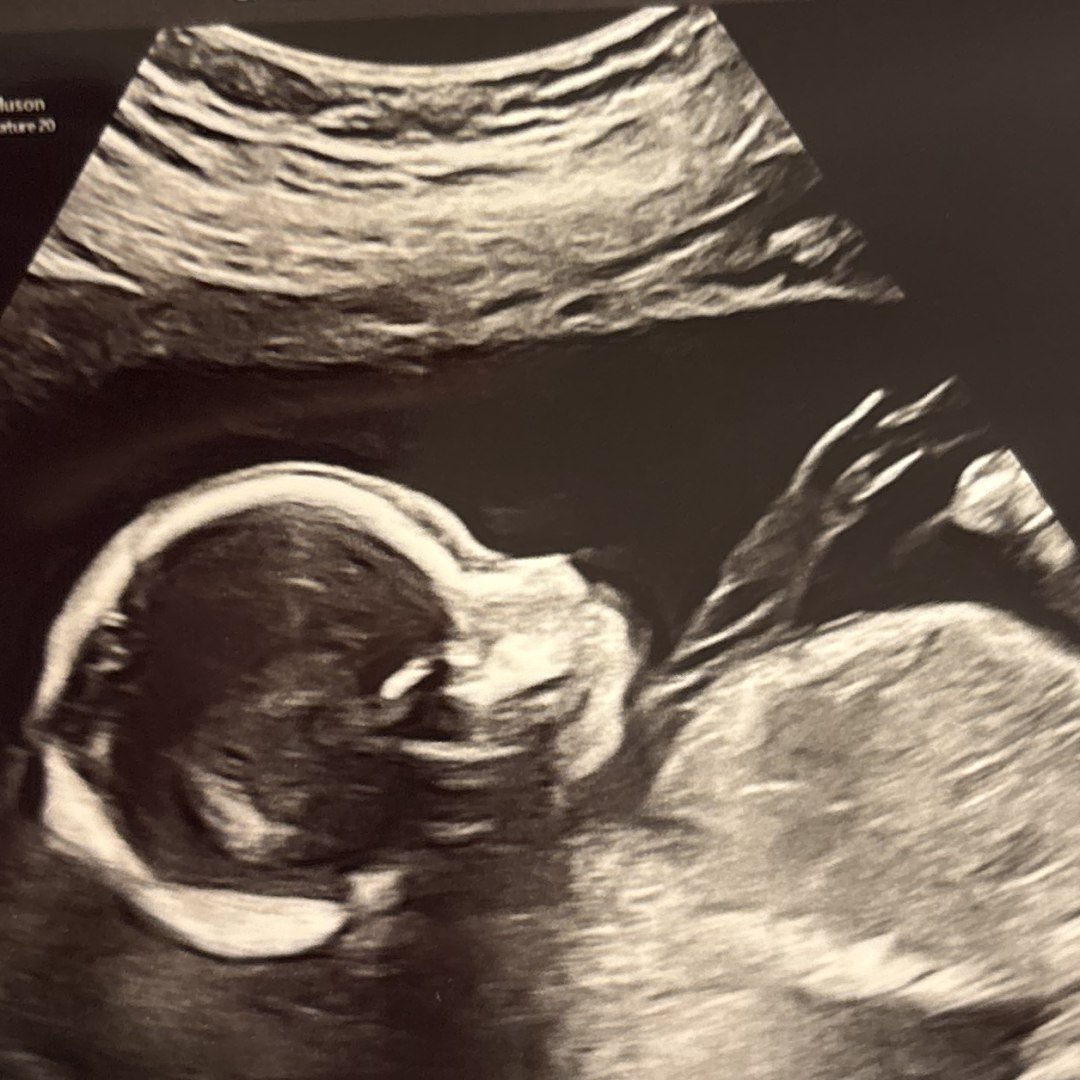 Photo shared by Jamila for their Babylist baby registry.